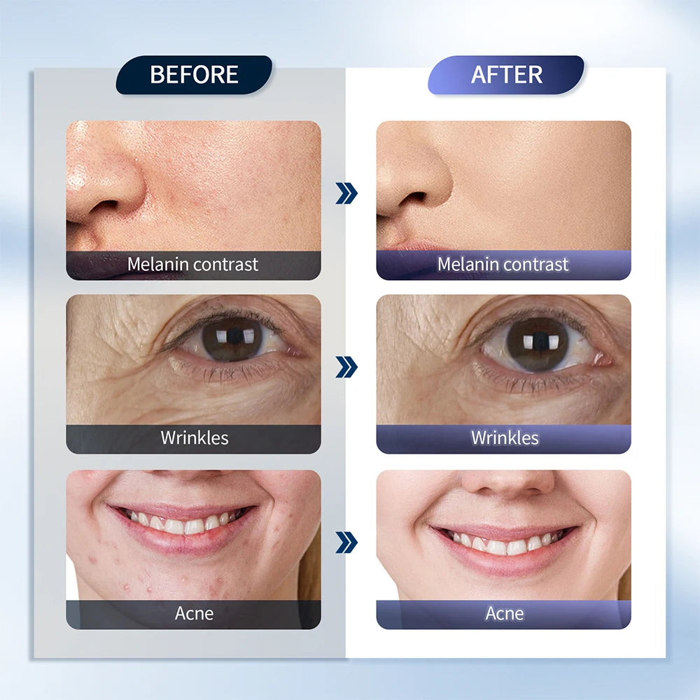 LUNARA LIGHT™ HydroGlow Station – 7-Color LED + NanoMist Therapy for Face & Body