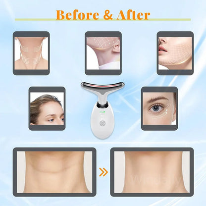 LunaraLight™ 7-in-1 LED Facial Sculptor