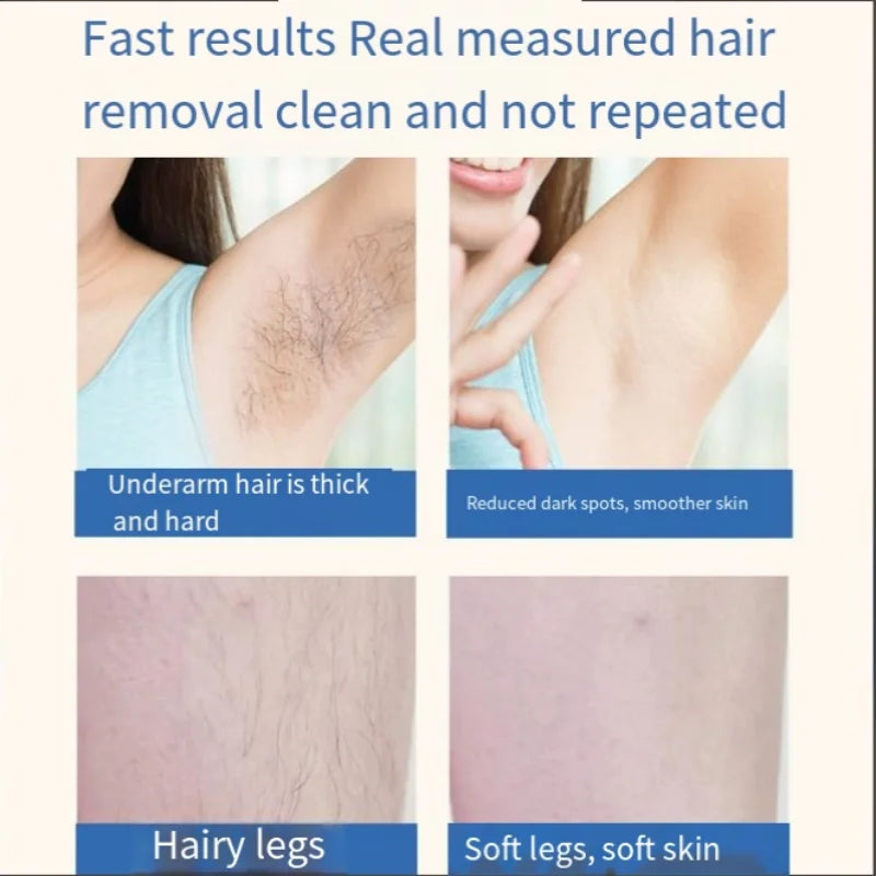 Lunara Light™ Mini Home Hair Removal Device